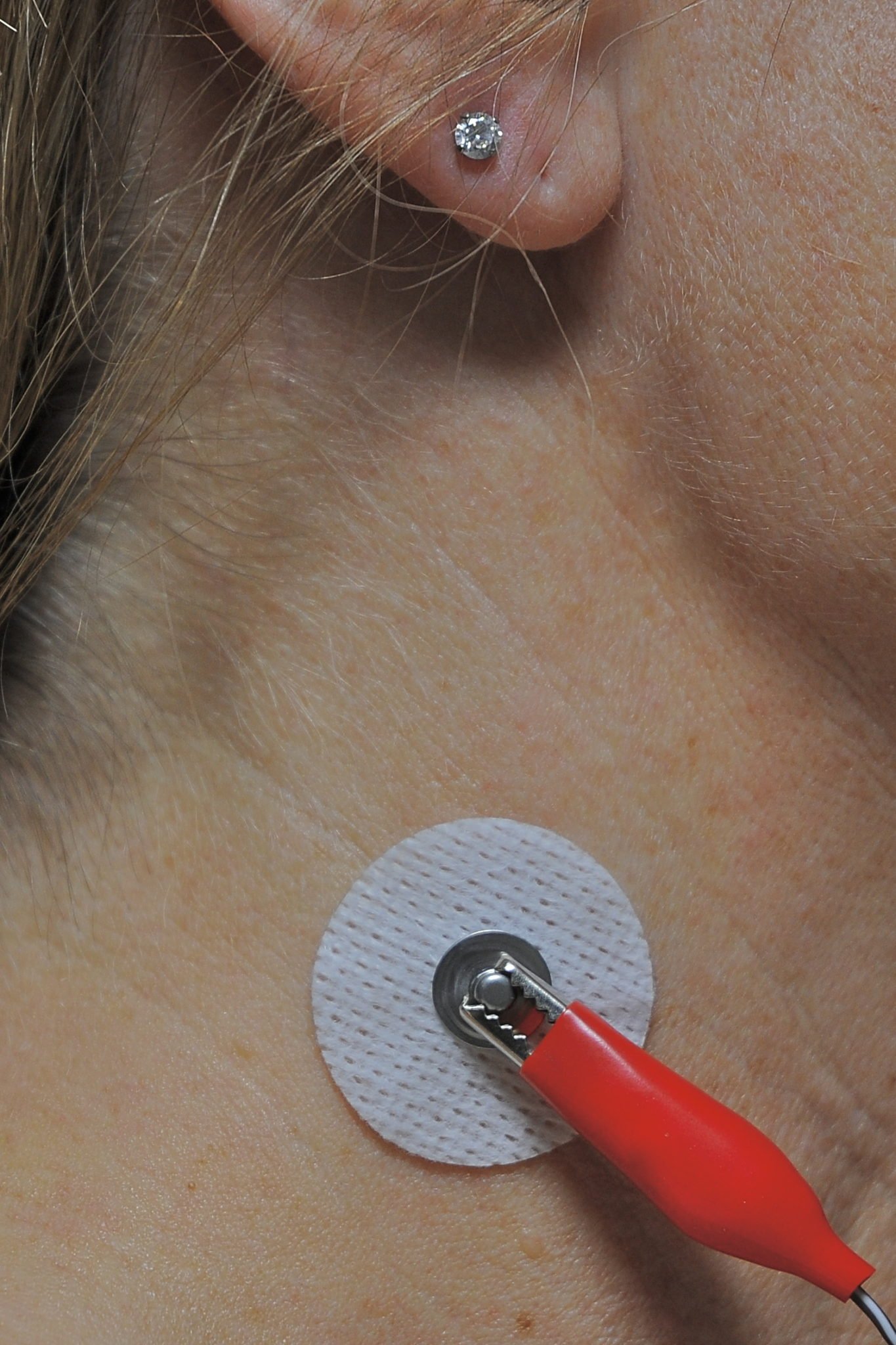Electrode Patches - Image 3